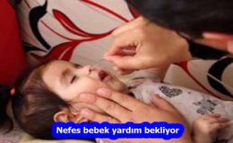 Nefes bebek yardım bekliyor